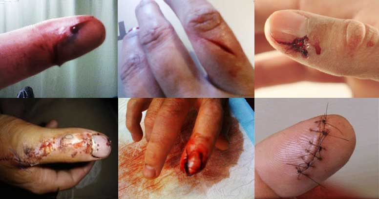 bloody-fingers